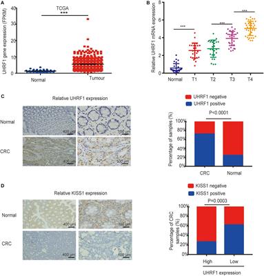 MiR-506 Targets UHRF1 to Inhibit Colorectal Cancer Proliferation and Invasion via the <mark class="highlighted">KISS1</mark>/PI3K/NF-κB Signaling Axis